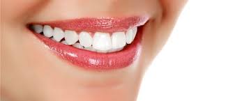 نتائج ابتسامة هوليوود قبل وبعد العلاج